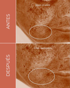 Sérum antioxidante / Vitamina C 15% - Brightening Drops, foto 4 de 10