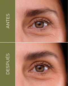 Gel fijador y fortalecedor de cejas / Folia - Anargy 2,5% + Biocapigen 5% + Pantenol, foto 4 de 10